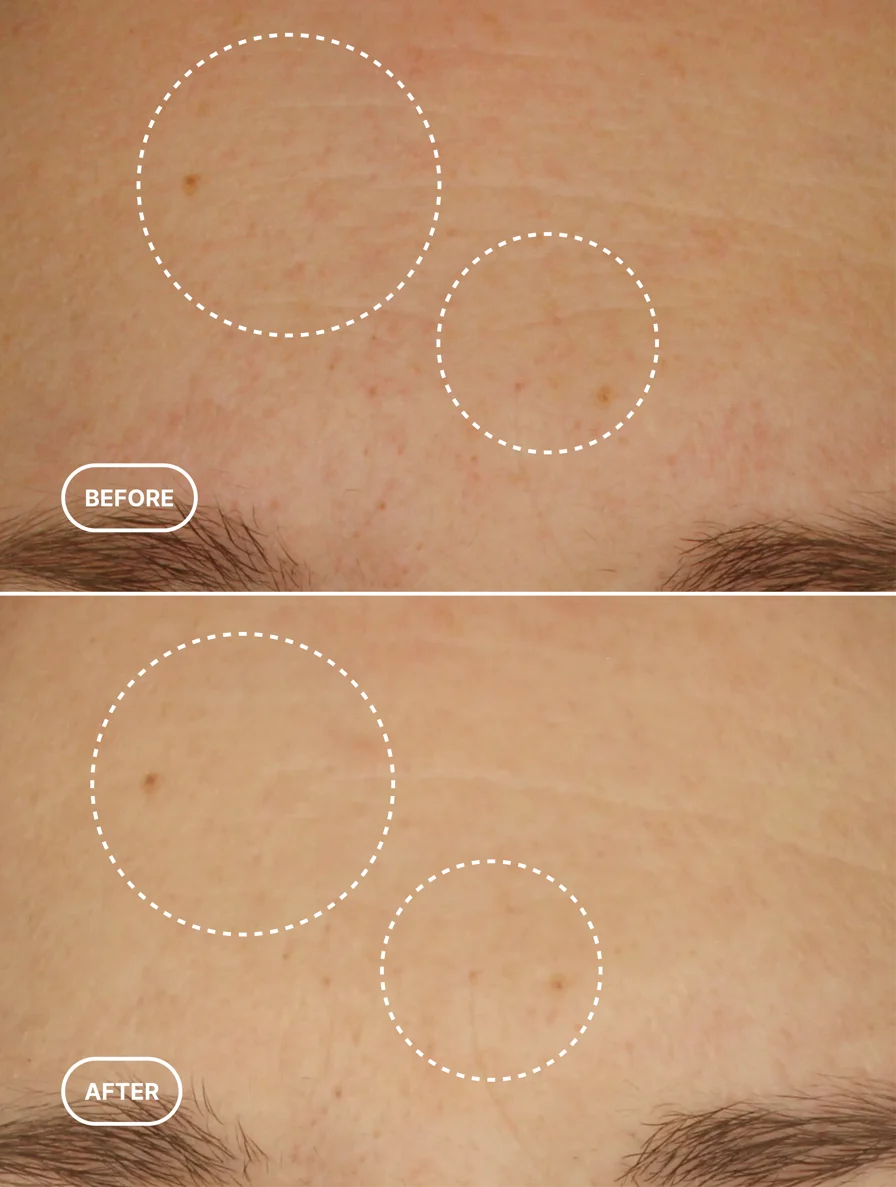 Retinol-Alternative-Serum