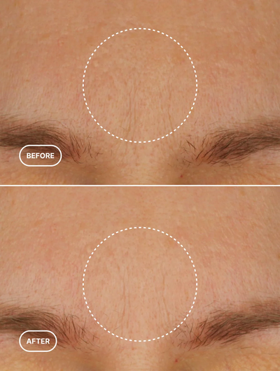 Retinol-Alternative Feuchtigkeitscreme